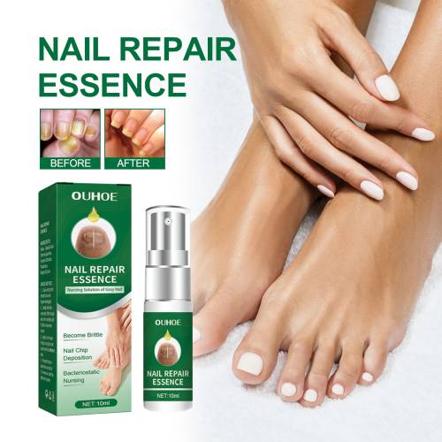 Mugwort Toenail Essence