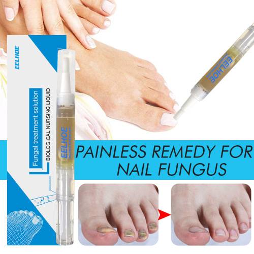 Jojoba Peppermint Nail Care Solution
