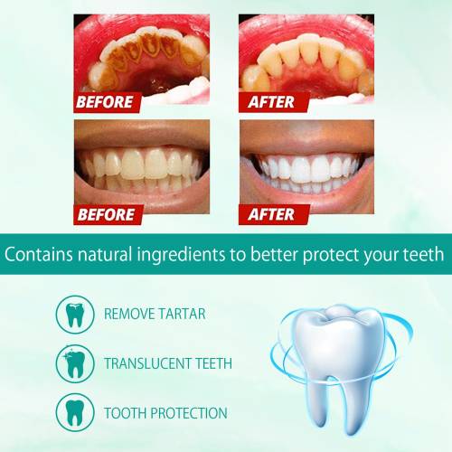 Whitening Foam Toothpaste with Mint