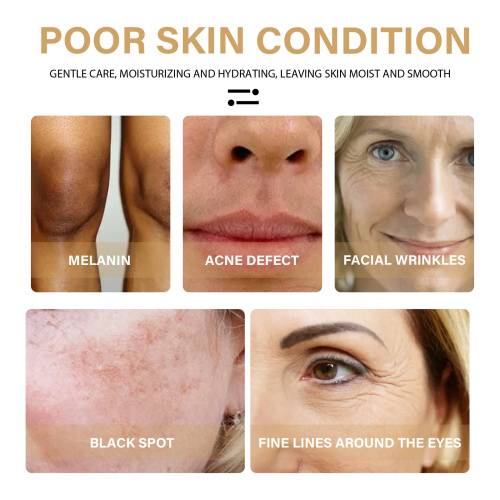 Turmeric Dark Spot Essence