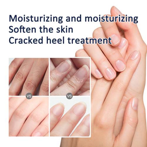 Shea Butter Hand & Foot Cream for Cracked Skin