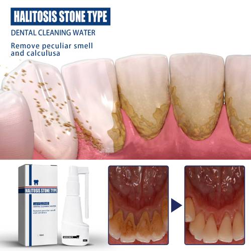 Teeth Cleaning Mist Spray