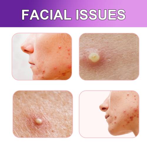 Tea Tree Pimple Patches