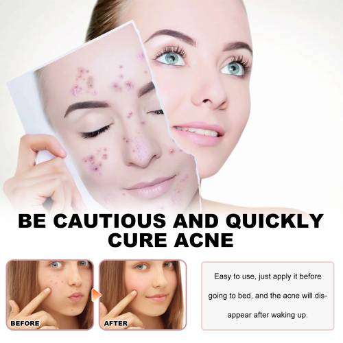 Sea Life Pimple Patches