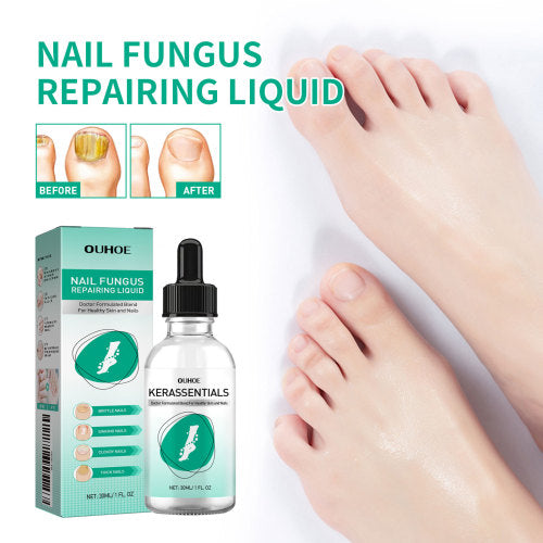 Gentle Nail Care Solution