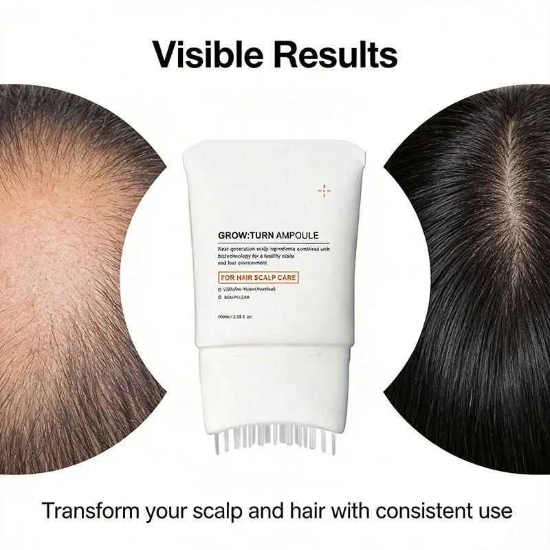 Exosome Scalp Serum 100ml with Built-In Massage Brush – Nourishing Hair and Scalp Care