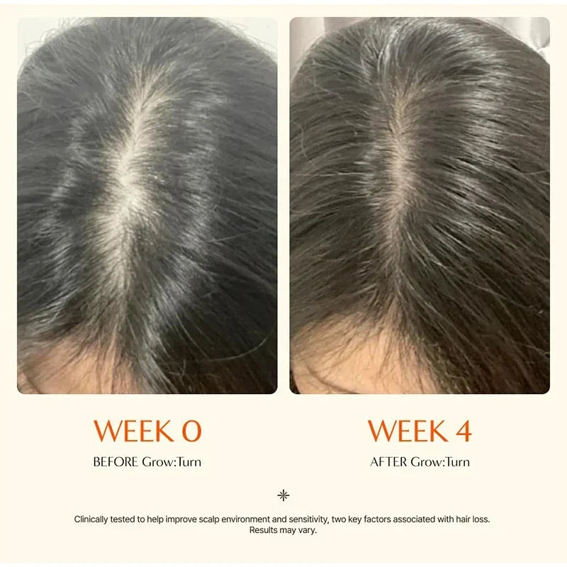 Exosome Scalp Serum 100ml with Built-In Massage Brush – Nourishing Hair and Scalp Care