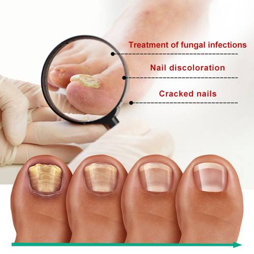 Gentle Nail Care Solution