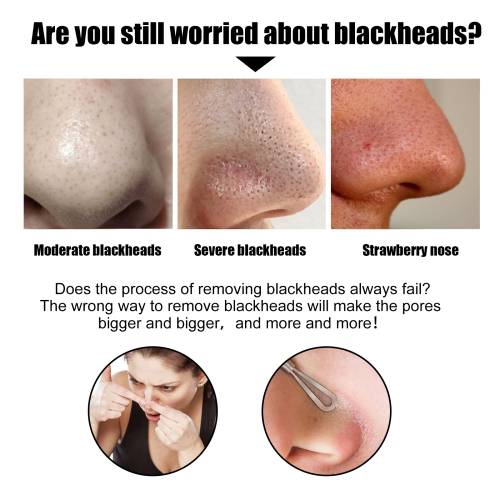 Bamboo Charcoal Nose Strips for Blackheads