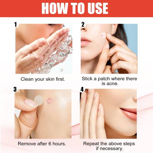 Invisible Hydrocolloid Pimple Patches, Waterproof