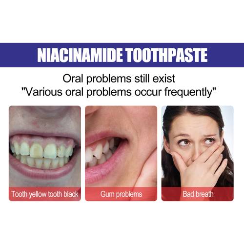 Niacinamide Whitening Toothpaste