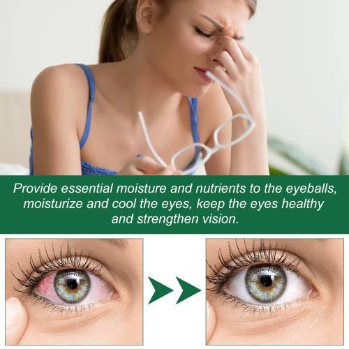 Cooling Eye Mist