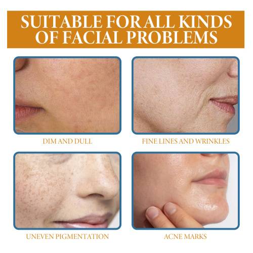 Retinol Face Serum for Fine Lines & Uneven Tone