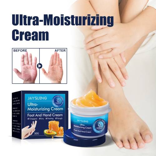 Shea Butter Hand & Foot Cream for Cracked Skin