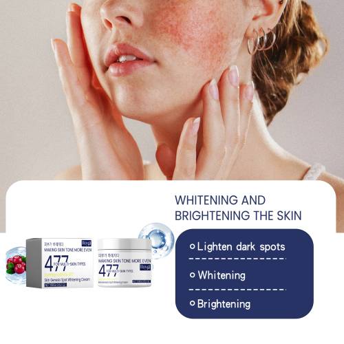 Kojic Acid Dark Spot Cream, Brightening