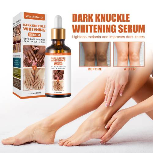 Brightening Serum for Knees, Elbows & Ankles, 50 g