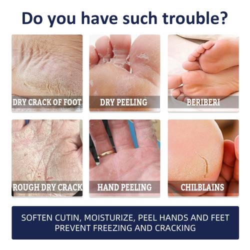 Shea Butter Hand & Foot Cream for Cracked Skin