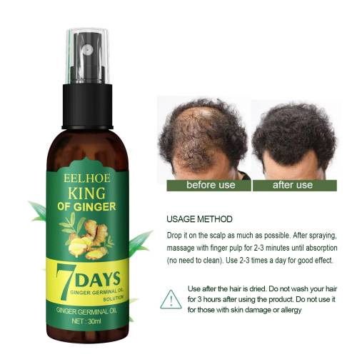 Ginger Scalp Spray, 30 ml