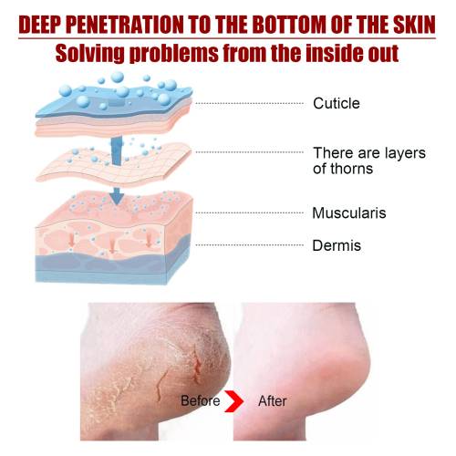 Exfoliating Foot Peel Mask with Salicylic & Malic Acid