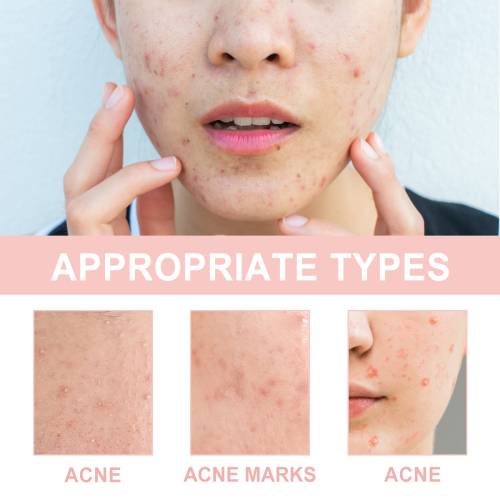 Hydrating Pimple Patches