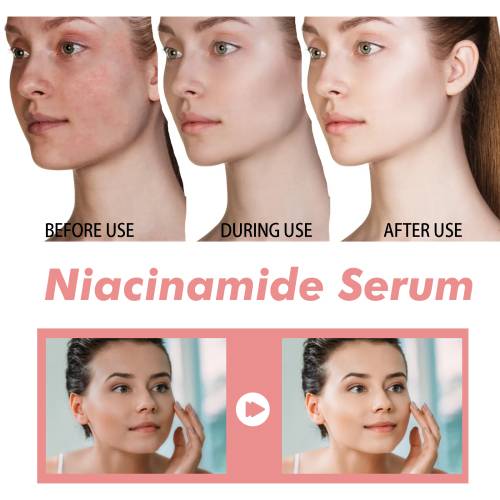 Niacinamide Face Essence, Pore Refining
