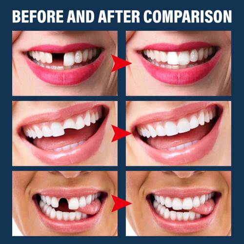 Halloween Vampire Fangs with Tooth Putty
