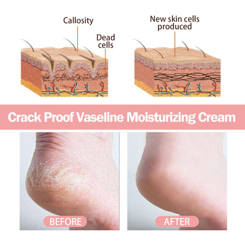 Hand & Foot Moisturizing Stick for Cracked Skin