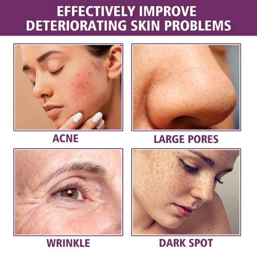 Niacinamide & Purslane Face Serum