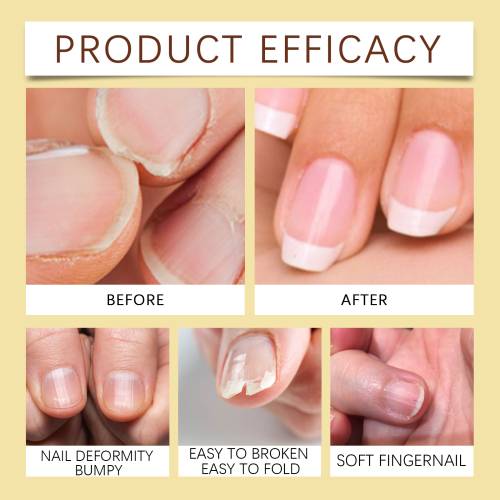 Jojoba Cuticle Oil with Vitamins C & E