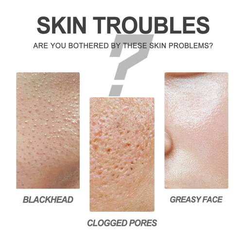 Blackhead Nose Cleansing Cream & Pore Strips