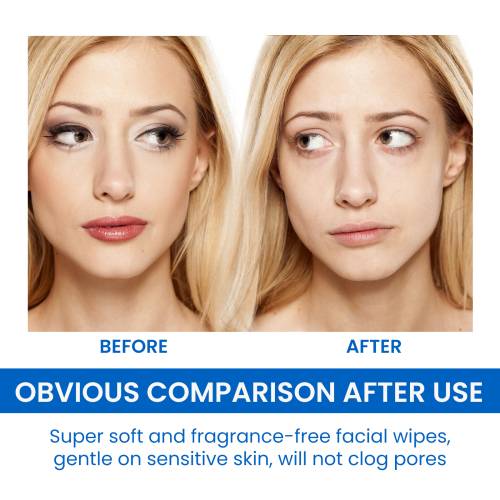 Gentle Makeup Remover Wipes with Chamomile & Aloe