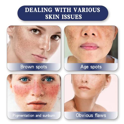 Kojic Acid Dark Spot Cream, Brightening