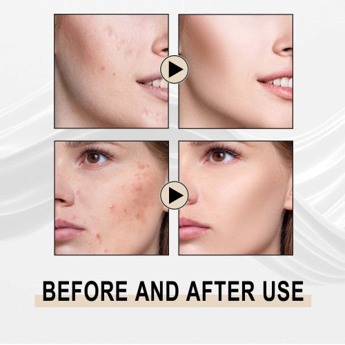 Glycolic Acid Exfoliating Face Essence for Blackheads