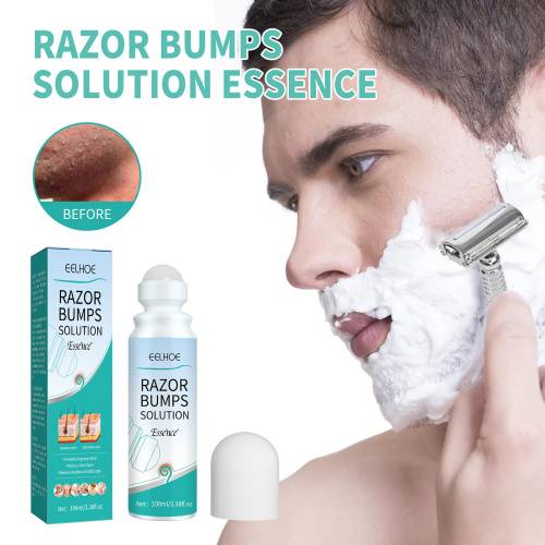 Razor Bump Roll-On Serum