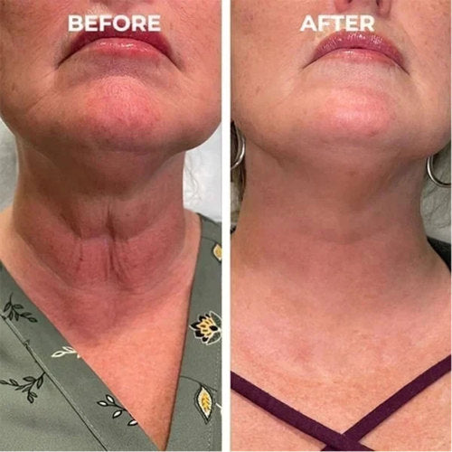 Peptide Face Essence Lotion with B5 & Hyaluronic Acid