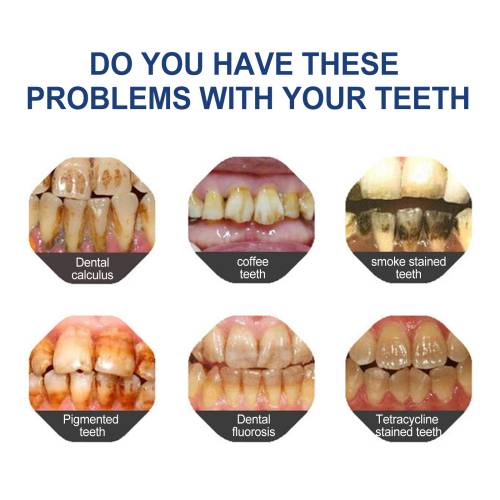 Blueberry Teeth Whitening Paint