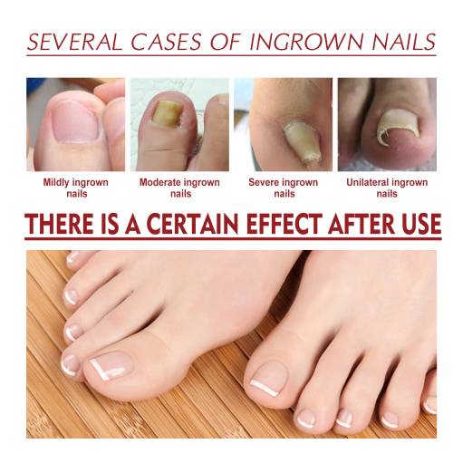 Nail Care Oil