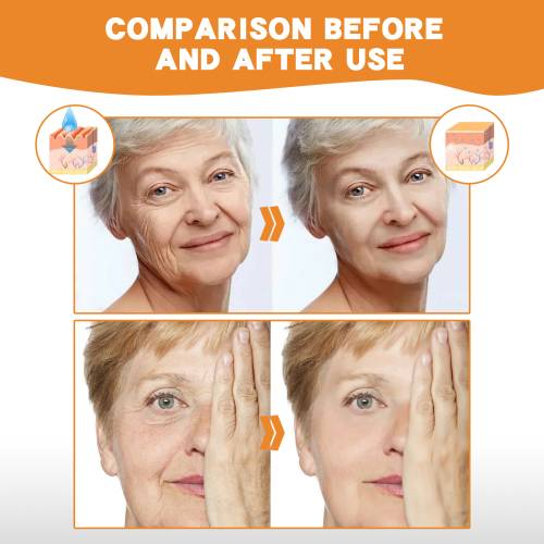 Snail Peptide Collagen Serum Set with Dissolving Patches