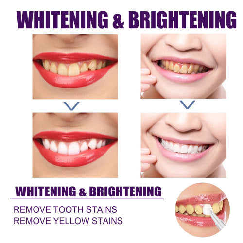 V34 Purple Tooth Brightening Pen