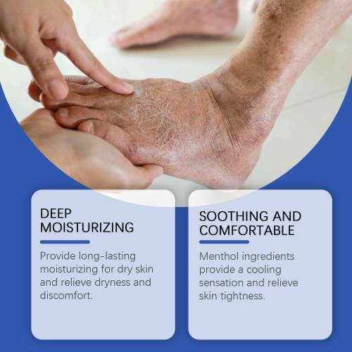 Cooling Peppermint Body Moisturizer for Feet & Legs
