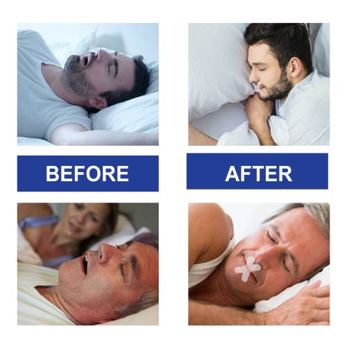 Breathable Mouth Sleep Tape