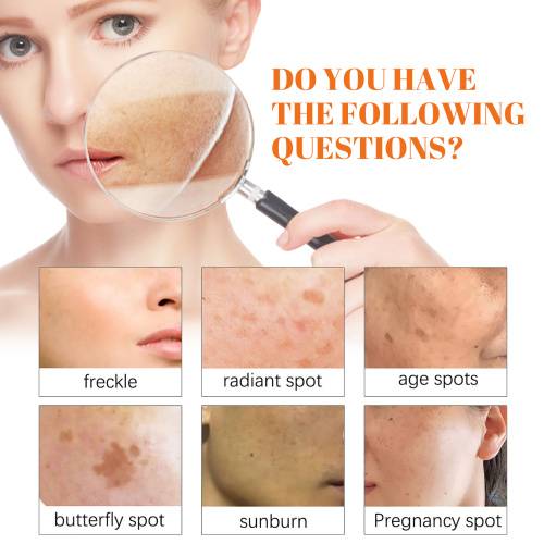 Papaya Day & Night Cream for Dark Spots