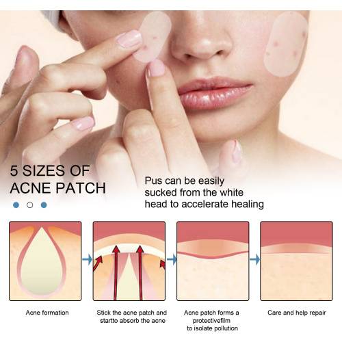 Invisible Hydrocolloid Pimple Patches