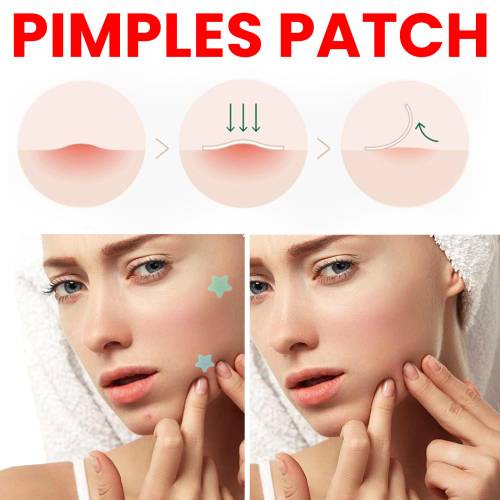 Hydrocolloid Pimple Patches with Tea Tree