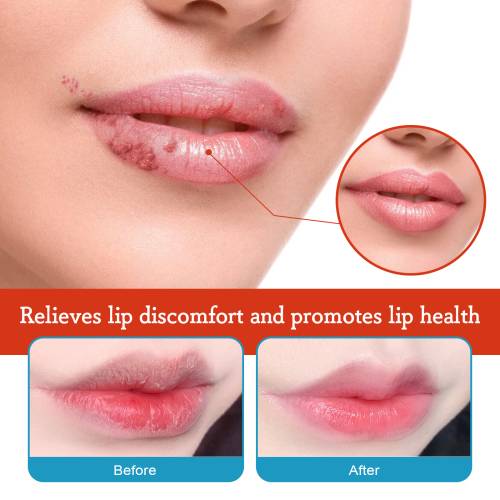 Lip Care Cream with Centella & Shea Butter