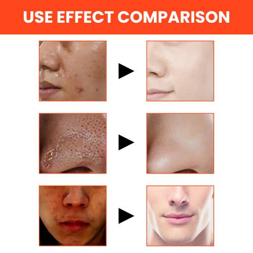 Men's Volcanic Face Wash, Deep Pore Cleansing & Oil Control