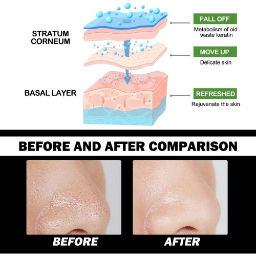 Bamboo Charcoal Peel-Off Mask for Blackheads