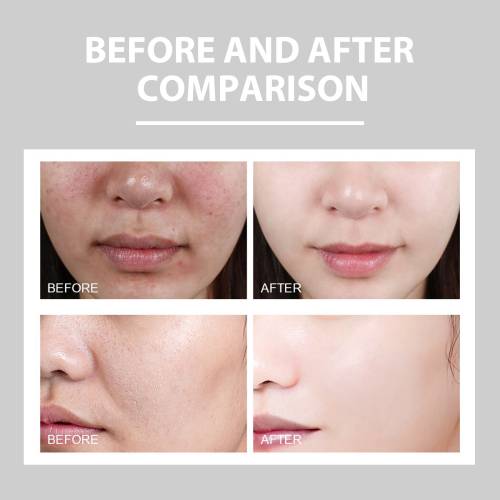 Niacinamide Hydrating Face Cream for Oily Skin