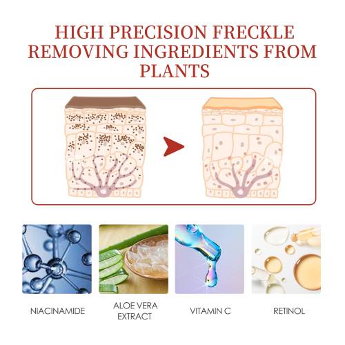 Dark Spot Cream with Retinol & Vitamin C