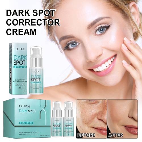 Moisturizing Face Cream for Spots & Dullness
